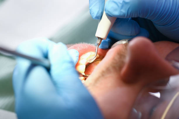 Best Knocked-Out Tooth Emergency  in Des C, AR