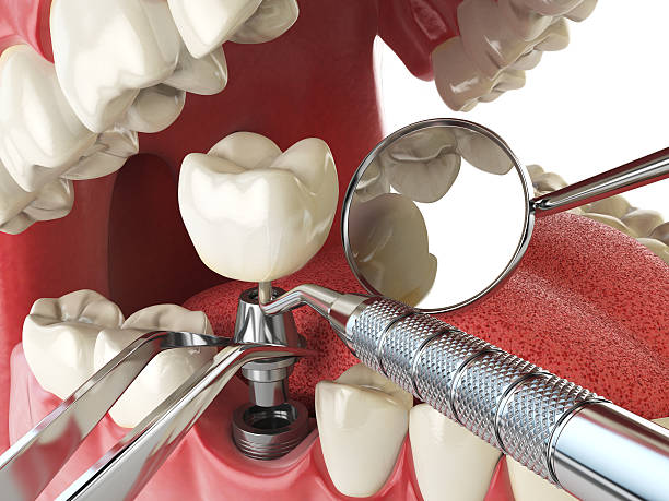 Best Tooth Pain Emergency Relief  in Des C, AR